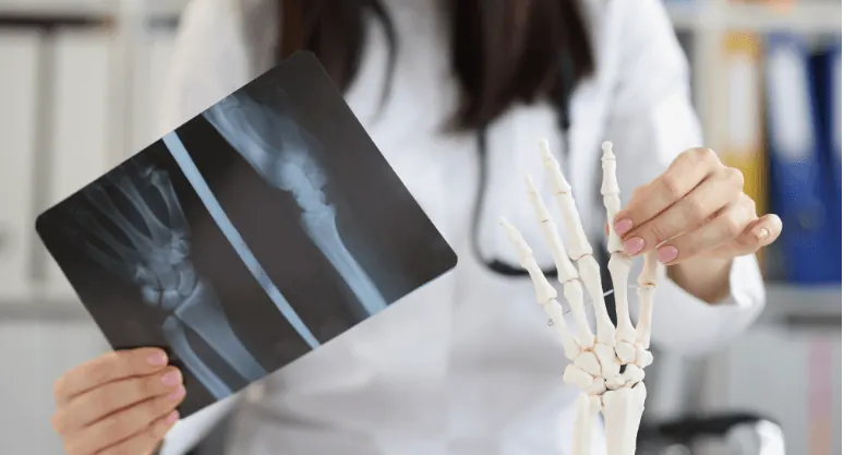 Doctor comparing a wrist X-ray with a skeleton model