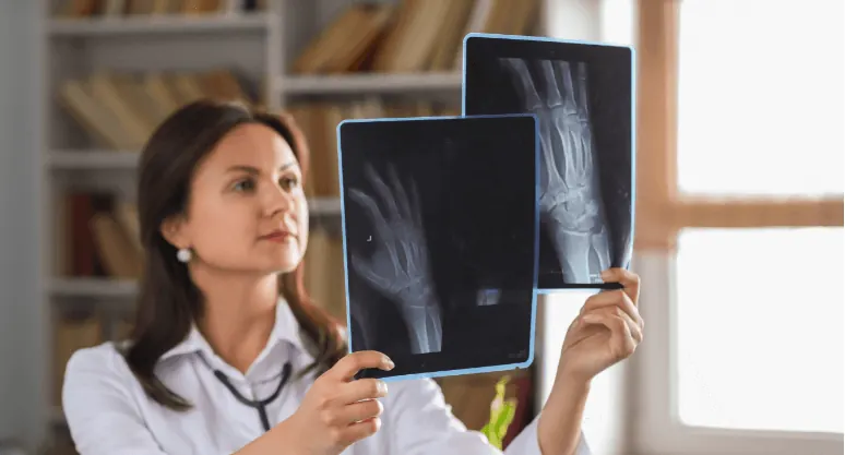 Radiologist comparing two hand X-rays