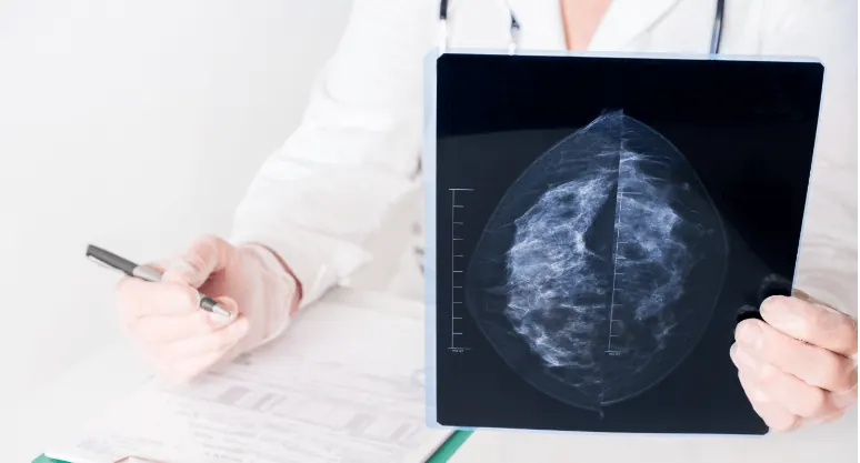 Radiologist holding a mammogram while writing a report
