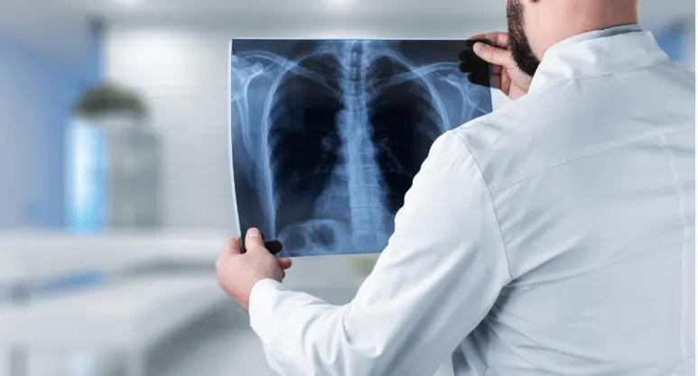 Radiologist examining a chest X-ray